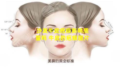 沙发牛皮疤痕影响质量吗 牛皮的疤痕图片